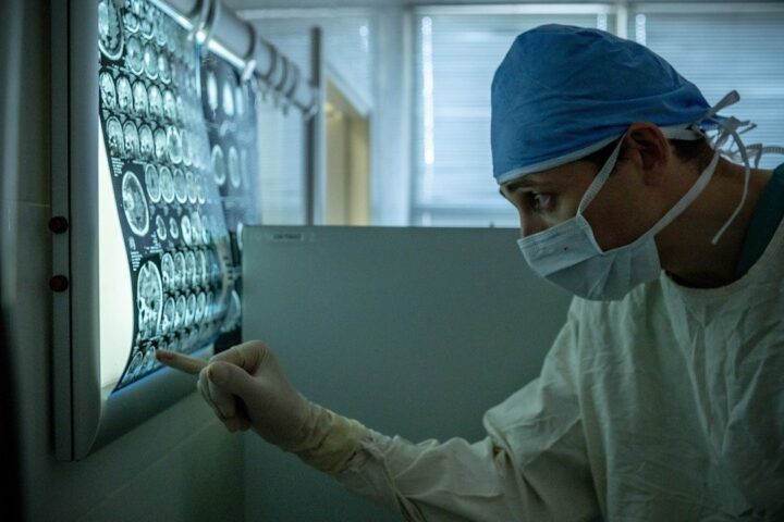 Doctor studying brain scans on a light box
