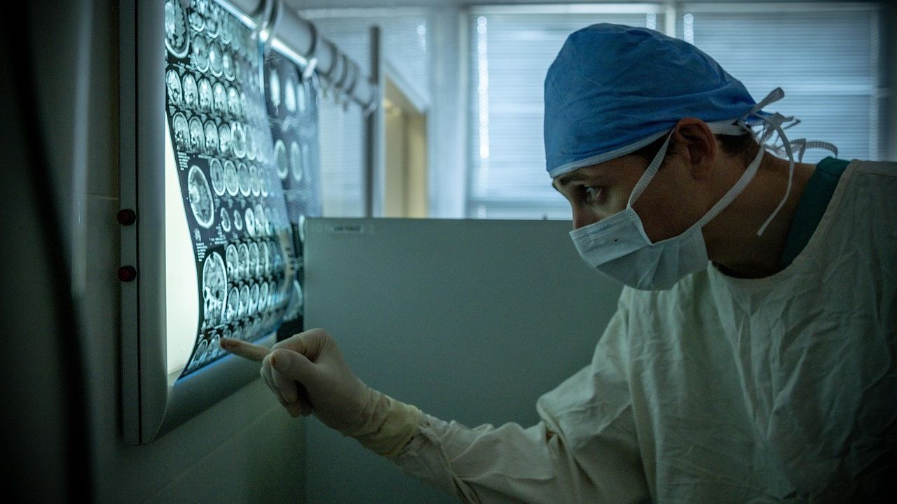 Doctor studying brain scans on a light box