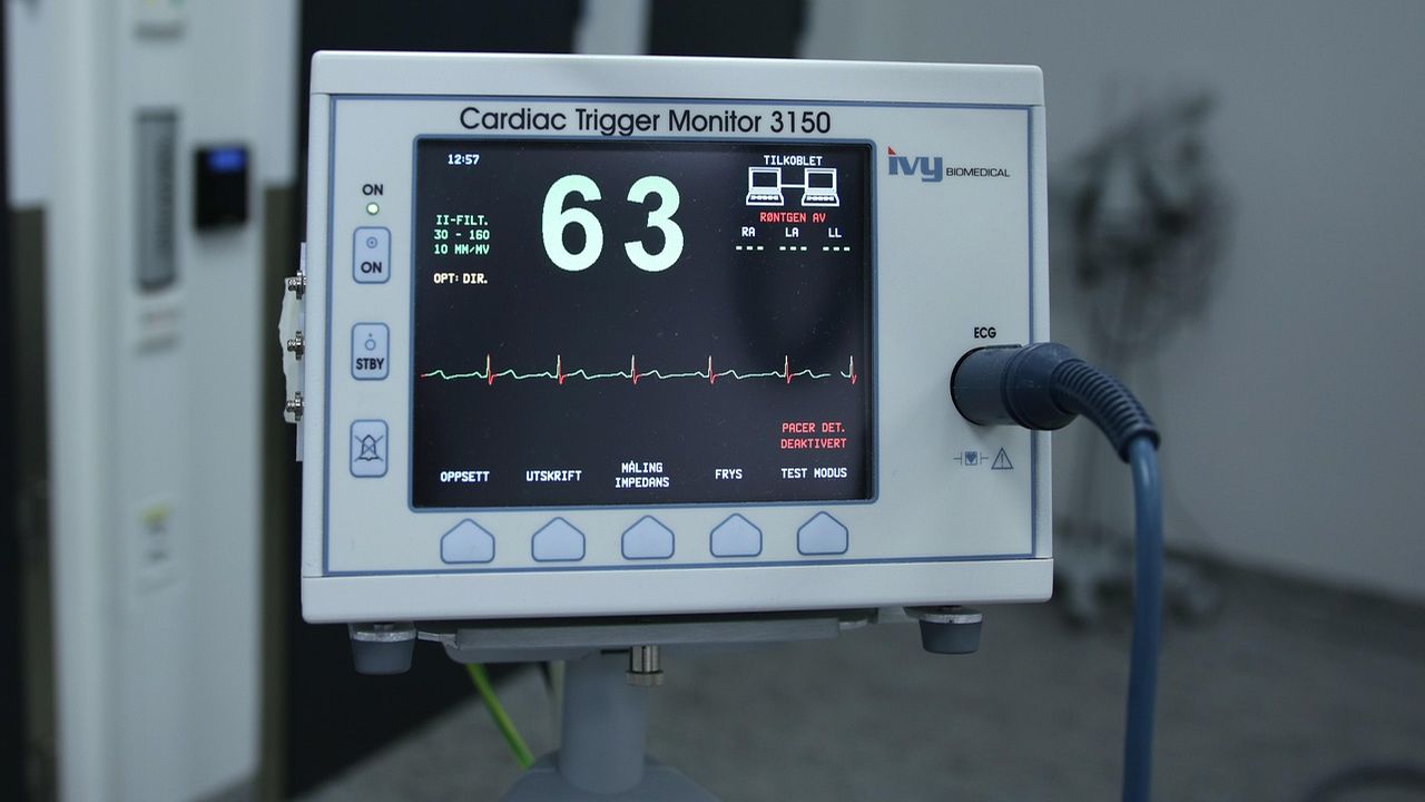 Cardiac monitor showing a heart rate of 63
